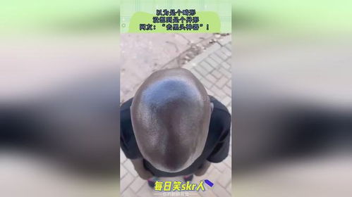 房产软文怎么去黑头正确