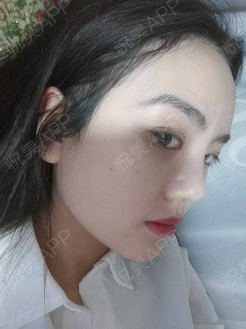 感情运势：整容会影响感情运势嘛女（整容会影响感情运势嘛女生）