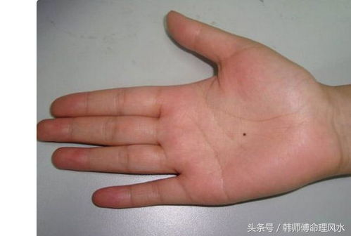 中指痣女人情缘之谜